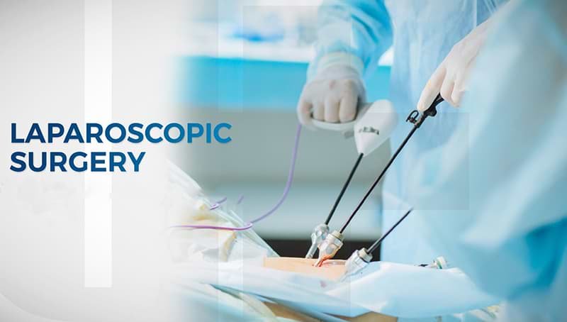 laparoscopic-surgery-in-Mumbai